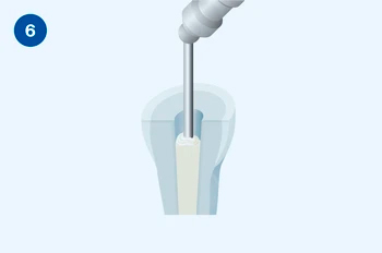 Применение Люксакор Z Дуал Смартмикс - этап 6